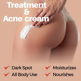 Beauty & Divine Butt Premium Treatment & Acne Cream - Apalipapa